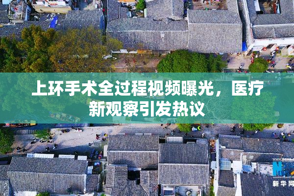 上环手术全过程视频曝光，医疗新观察引发热议