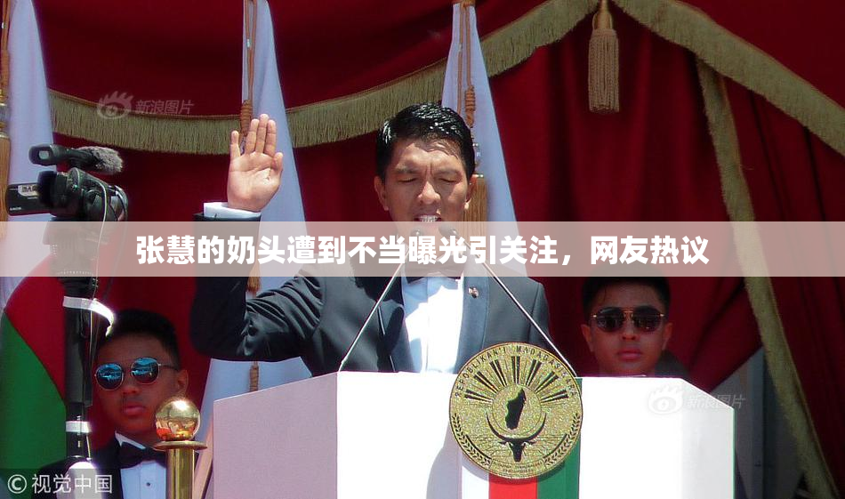 张慧的奶头遭到不当曝光引关注，网友热议