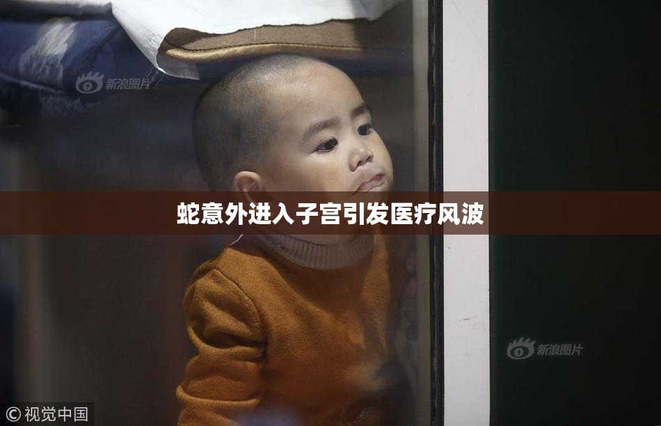 蛇意外进入子宫引发医疗风波