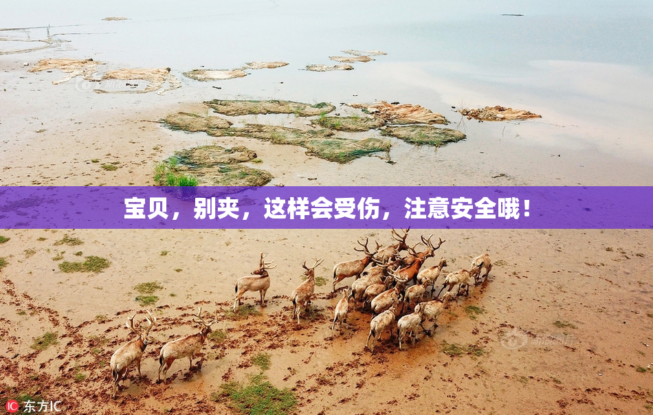 宝贝，别夹，这样会受伤，注意安全哦！
