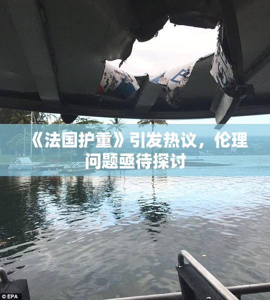 《法国护重》引发热议，伦理问题亟待探讨