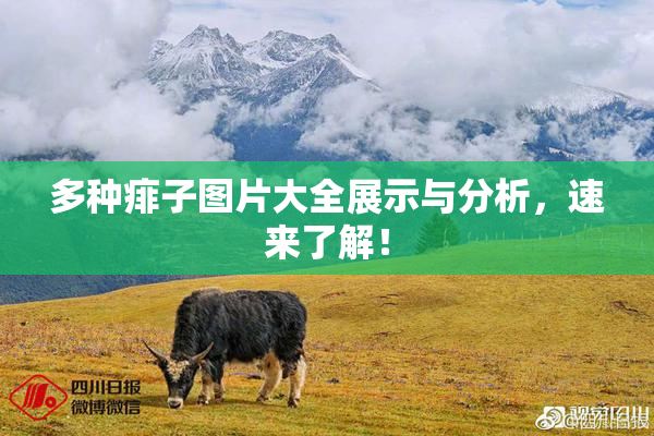 多种痱子图片大全展示与分析，速来了解！