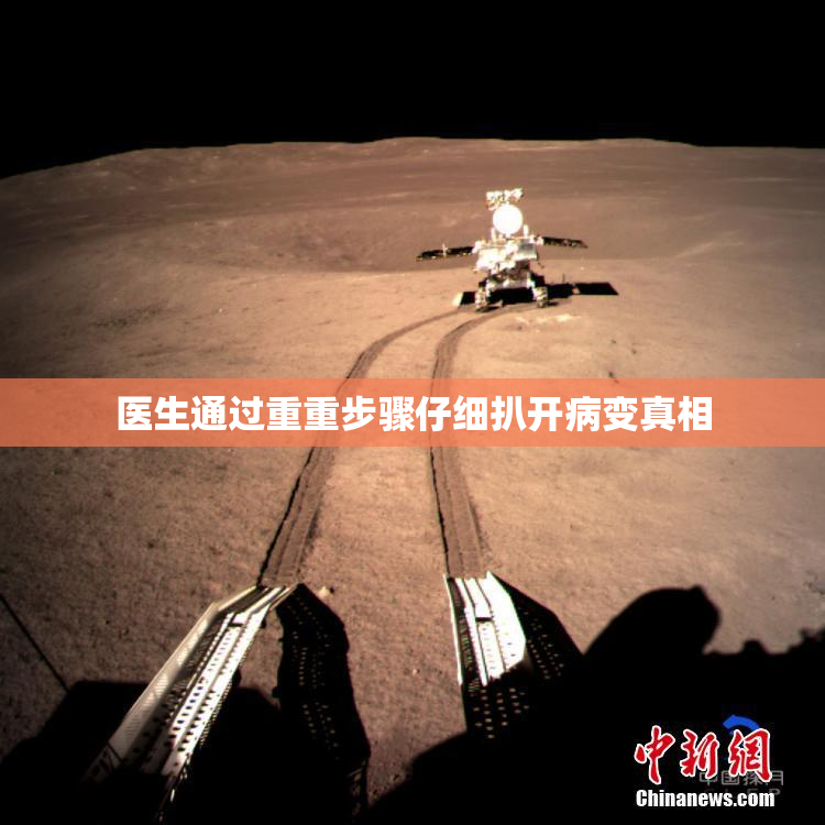 医生通过重重步骤仔细扒开病变真相