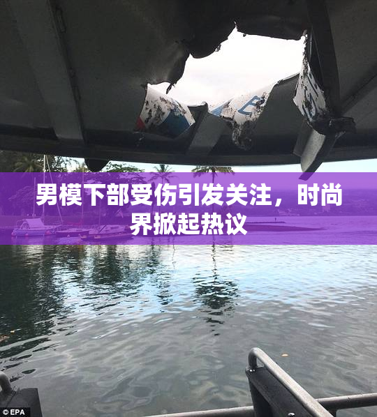 男模下部受伤引发关注，时尚界掀起热议