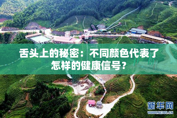 舌头上的秘密：不同颜色代表了怎样的健康信号？