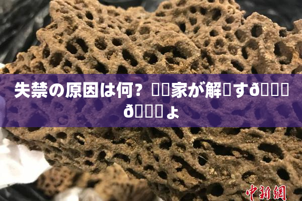 失禁の原因は何？専門家が解説す🌃🎆ょ