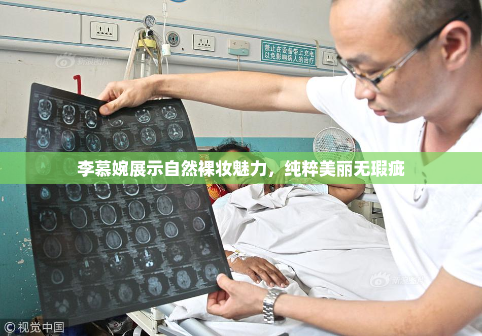李慕婉展示自然裸妆魅力，纯粹美丽无瑕疵