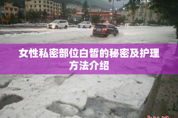 女性私密部位白皙的秘密及护理方法介绍