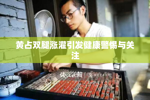 黄占双腿涨灌引发健康警惕与关注